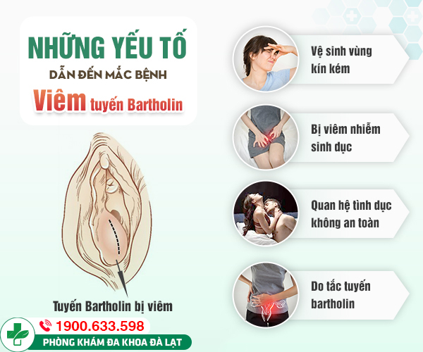 Hình ảnh minh họa
